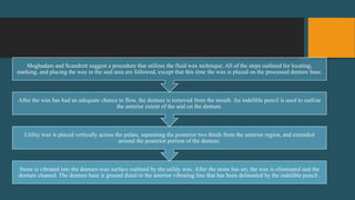 Stone is vibrated into the denture-wax surface outlined by the utility wax. After the stone has set, the wax is eliminated and the
denture cleaned. The denture base is ground distal to the anterior vibrating line that has been delineated by the indelible pencil .
Utility wax is placed vertically across the palate, separating the posterior two thirds from the anterior region, and extended
around the posterior portion of the denture.
After the wax has had an adequate chance to flow, the denture is removed from the mouth. An indelible pencil is used to outline
the anterior extent of the seal on the denture.
Moghadam and Scandrett suggest a procedure that utilizes the fluid wax technique. All of the steps outlined for locating,
marking, and placing the wax in the seal area are followed, except that this time the wax is placed on the processed denture base.
 