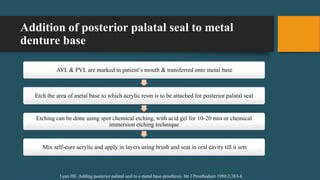 Addition of posterior palatal seal to metal
denture base
AVL & PVL are marked in patient’s mouth & transferred onto metal base
Etch the area of metal base to which acrylic resin is to be attached for posterior palatal seal
Etching can be done using spot chemical etching, with acid gel for 10-20 min or chemical
immersion etching technique
Mix self-cure acrylic and apply in layers using brush and seat in oral cavity till it sets
Lyan HE. Adding posterior palatal seal to a metal base prosthesis. Int J Prosthodont 1989;2:283-4.
 