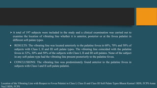  A total of 197 subjects were included in the study and a clinical examination was carried out to
examine the location of vibrating line whether it is anterior, posterior or at the fovea palatini in
different soft palate types.
 RESULTS: The vibrating line was located anteriorly to the palatine fovea in 68%, 70% and 50% of
subjects with Class I, II and III soft palate types. The vibrating line coincided with the palatine
fovea in 32%, 30% and 50% of the subjects with Class I, II and III soft palates. None of the subject
in any soft palate type had the vibrating line present posteriorly to the palatine fovea.
 CONCLUSIONS: The vibrating line was predominately found anterior to the palatine fovea in
subjects with Class I and II soft palate palatini.
Location of the Vibrating Line with Respect to Fovea Palatini in Class I, Class II and Class III Soft Palate Types Bharat Kumar1 BDS, FCPS Asma
Naz2 BDS, FCPS
 