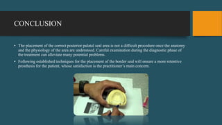 CONCLUSION
• The placement of the correct posterior palatal seal area is not a difficult procedure once the anatomy
and the physiology of the area are understood. Careful examination during the diagnostic phase of
the treatment can alleviate many potential problems.
• Following established techniques for the placement of the border seal will ensure a more retentive
prosthesis for the patient, whose satisfaction is the practitioner’s main concern.
 