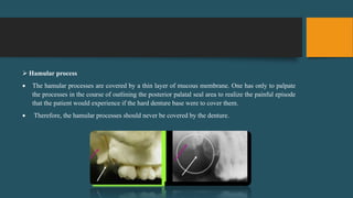  Hamular process
 The hamular processes are covered by a thin layer of mucous membrane. One has only to palpate
the processes in the course of outlining the posterior palatal seal area to realize the painful episode
that the patient would experience if the hard denture base were to cover them.
 Therefore, the hamular processes should never be covered by the denture.
 