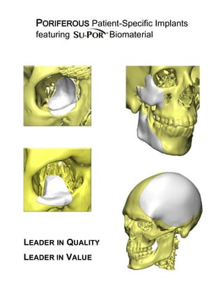 PORIFEROUS Patient-Specific Implants
featuring Biomaterial
LEADER IN QUALITY
LEADER IN VALUE
 