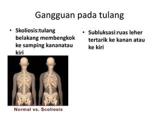 Gangguan pada tulang
• Skoliosis:tulang
belakang membengkok
ke samping kananatau
kiri

• Subluksasi:ruas leher
tertarik ke kanan atau
ke kiri

 