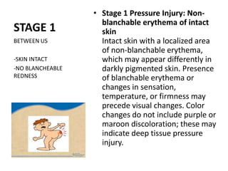 STAGE 1
• Stage 1 Pressure Injury: Non-
blanchable erythema of intact
skin
Intact skin with a localized area
of non-blanchable erythema,
which may appear differently in
darkly pigmented skin. Presence
of blanchable erythema or
changes in sensation,
temperature, or firmness may
precede visual changes. Color
changes do not include purple or
maroon discoloration; these may
indicate deep tissue pressure
injury.
BETWEEN US
-SKIN INTACT
-NO BLANCHEABLE
REDNESS
 