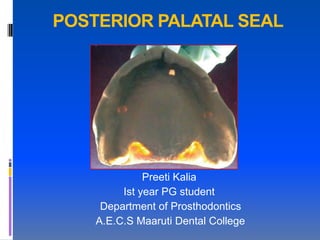 POSTERIOR PALATAL SEAL




              Preeti Kalia
         Ist year PG student
     Department of Prosthodontics
    A.E.C.S Maaruti Dental College
 