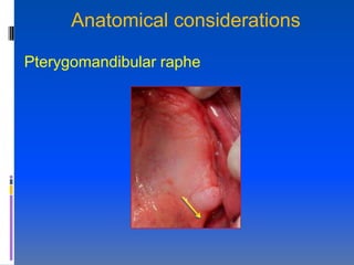 Anatomical considerations

Pterygomandibular raphe
 