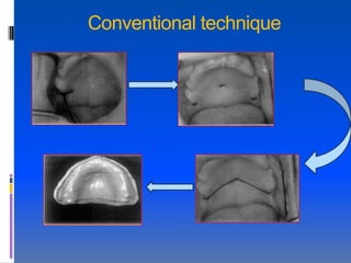 Conventional technique
 