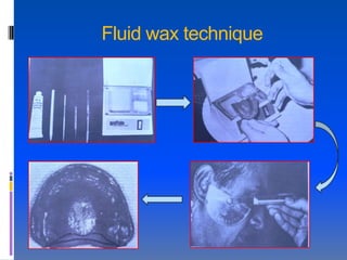 Fluid wax technique
 