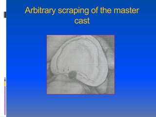 Arbitrary scraping of the master
              cast
 