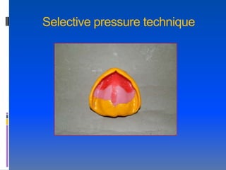 Selective pressure technique
 