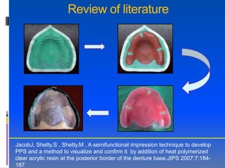 Review of literature




JacobJ, Shetty.S , Shetty.M , A semifunctional impression technique to develop
PPS and a method to visualize and confirm it by addition of heat polymerized
clear acrylic resin at the posterior border of the denture base.JIPS 2007:7;184-
187
 