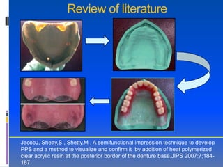 Review of literature




JacobJ, Shetty.S , Shetty.M , A semifunctional impression technique to develop
PPS and a method to visualize and confirm it by addition of heat polymerized
clear acrylic resin at the posterior border of the denture base.JIPS 2007:7;184-
187
 