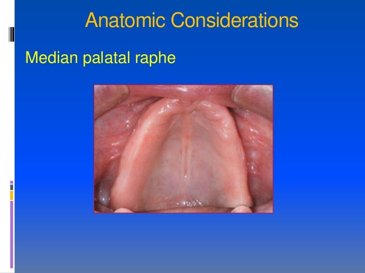 posterior palatal seal ppt