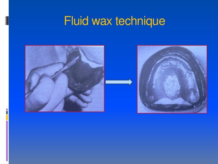 palatal fluid