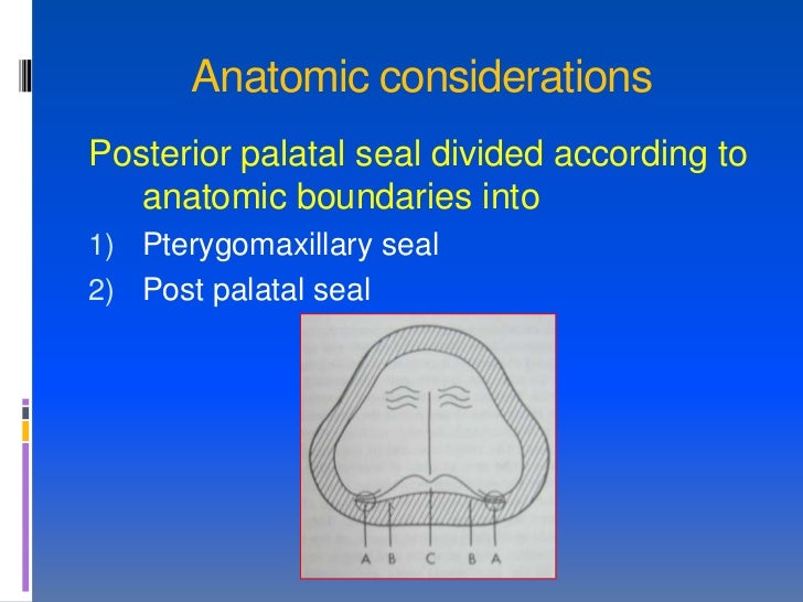 posterior palatal seal ppt