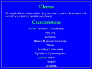 Es una pérdida de sustancia de la piel y mucosas con poca nula tendencia a la
curación y que tiende a persistir y agrandarse.




                      Fondo: Carnoso (T. Granulación).
                                      Rojo vivo.
                                     Sangrante.
                           Negro o N. verdosa Gangrenas.
                                       Pálidas.
                              Amarillo gris (infectadas).
                            Equimóticas o (hemorrágicas).
                               Aspecto: Bueno
                                       Fungoso
                                      Vegetante.
 