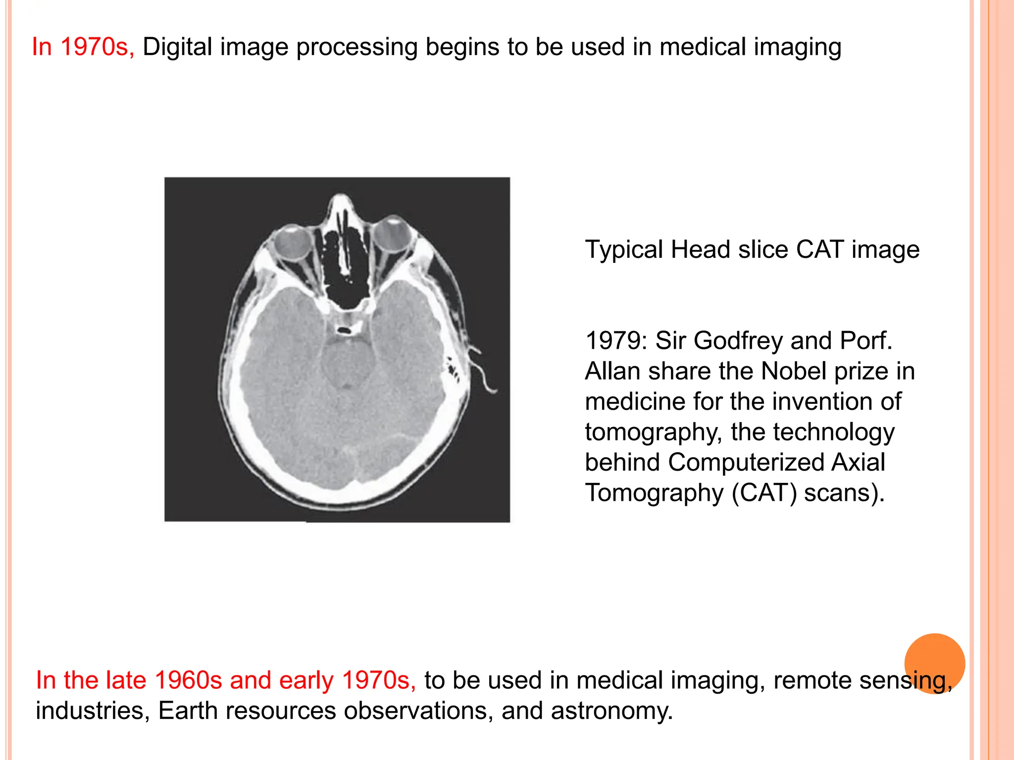 In the late 1960s and early 1970s, to be used in medical imaging, remote sensing,
industries, Earth resources observations, and astronomy.
In 1970s, Digital image processing begins to be used in medical imaging
Typical Head slice CAT image
1979: Sir Godfrey and Porf.
Allan share the Nobel prize in
medicine for the invention of
tomography, the technology
behind Computerized Axial
Tomography (CAT) scans).
 