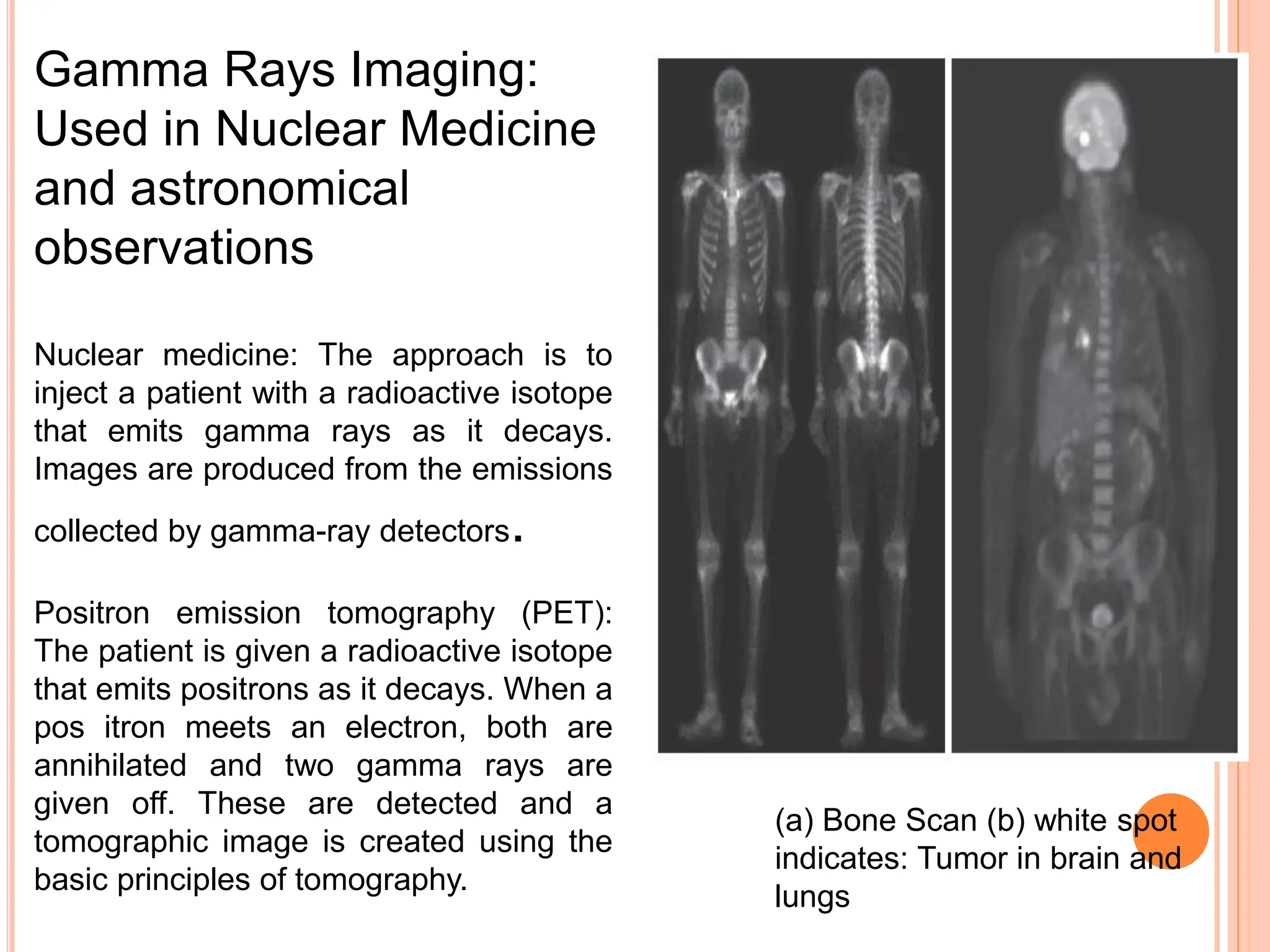 Gamma Rays Imaging:
Used in Nuclear Medicine
and astronomical
observations
Nuclear medicine: The approach is to
inject a patient with a radioactive isotope
that emits gamma rays as it decays.
Images are produced from the emissions
collected by gamma-ray detectors.
Positron emission tomography (PET):
The patient is given a radioactive isotope
that emits positrons as it decays. When a
pos itron meets an electron, both are
annihilated and two gamma rays are
given off. These are detected and a
tomographic image is created using the
basic principles of tomography.
(a) Bone Scan (b) white spot
indicates: Tumor in brain and
lungs
 