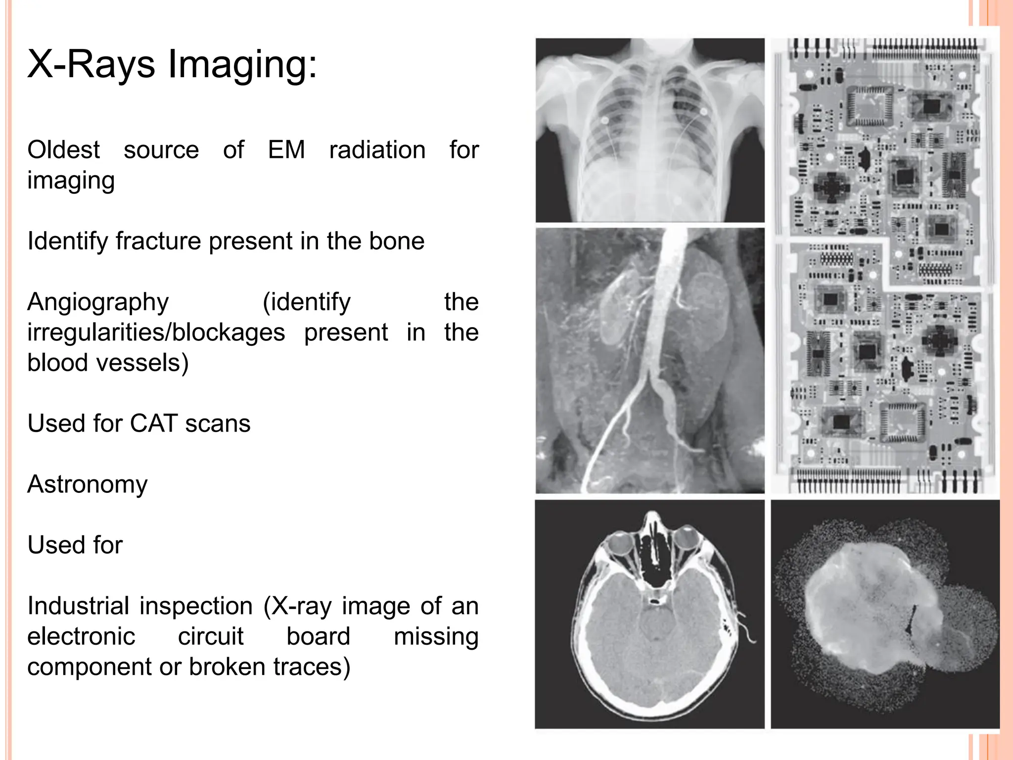 X-Rays Imaging:
Oldest source of EM radiation for
imaging
Identify fracture present in the bone
Angiography (identify the
irregularities/blockages present in the
blood vessels)
Used for CAT scans
Astronomy
Used for
Industrial inspection (X-ray image of an
electronic circuit board missing
component or broken traces)
 