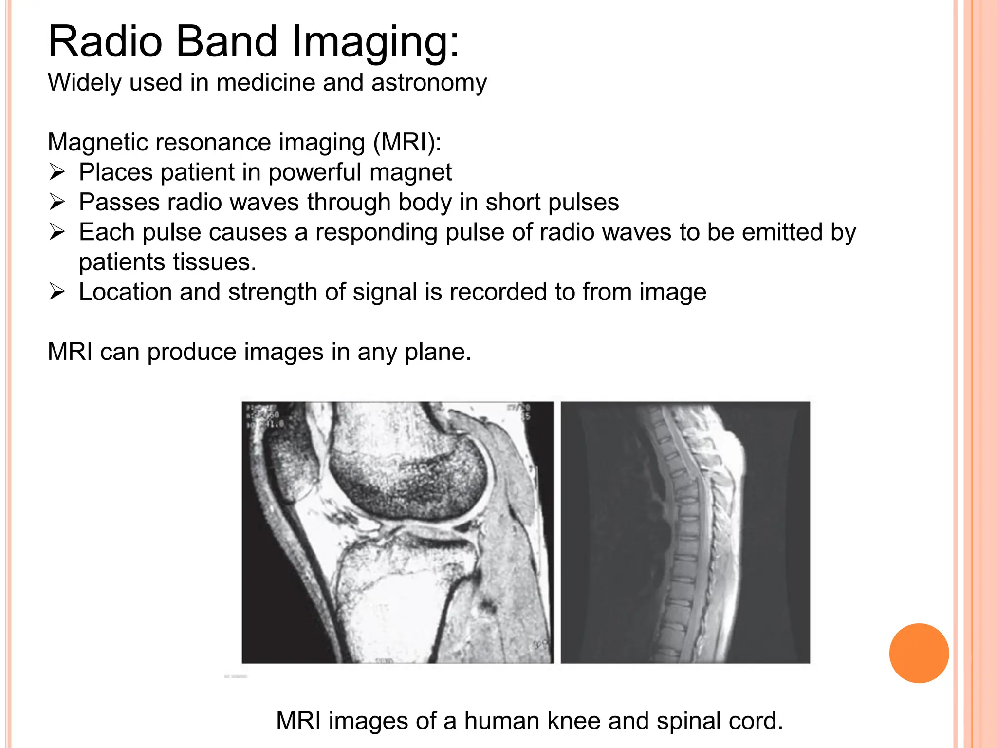 Radio Band Imaging:
Widely used in medicine and astronomy
Magnetic resonance imaging (MRI):
➢ Places patient in powerful magnet
➢ Passes radio waves through body in short pulses
➢ Each pulse causes a responding pulse of radio waves to be emitted by
patients tissues.
➢ Location and strength of signal is recorded to from image
MRI can produce images in any plane.
MRI images of a human knee and spinal cord.
 