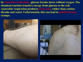 In anaerobic respiration, glucose breaks down without oxygen. The
chemical reaction transfers energy from glucose to the cell.
Anaerobic respiration produces lactic acid, rather than carbon
dioxide and water. Unfortunately this can lead to painful muscle
cramps.
 