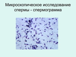 Микроскопическое исследование
спермы - спермограмма
 
