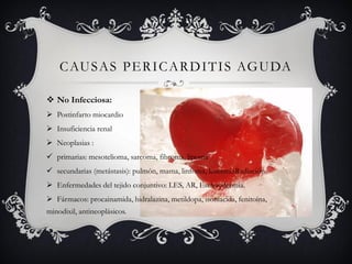 C AU S A S P E R I C A R D I T I S AG U DA

 No Infecciosa:
 Postinfarto miocardio
 Insuficiencia renal
 Neoplasias :
 primarias: mesotelioma, sarcoma, fibroma, lipoma
 secundarias (metástasis): pulmón, mama, linfoma, leucemiaRadiación
 Enfermedades del tejido conjuntivo: LES, AR, Esclerodermia.
 Fármacos: procainamida, hidralazina, metildopa, isoniacida, fenitoína,
minodixil, antineoplásicos.
 