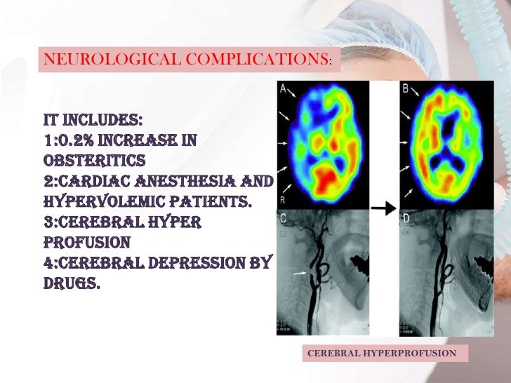 GENERAL ANESTHESIA AND ITS COMPLICATIONS