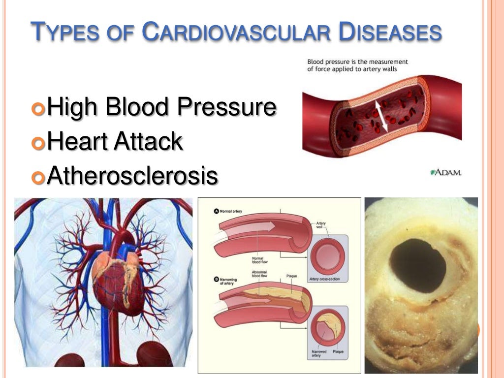 lifestyle-diseases