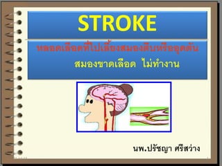 STROKE
หลอดเลือดที่ไปเลี้ยงสมองตีบหรืออุดตัน
สมองขาดเลือด ไม่ทางาน
นพ.ปรัชญา ศรีสว่าง
21-Jul-14 1
 