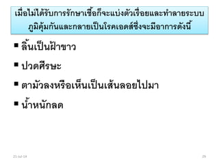 เมื่อไม่ได้รับการรักษาเชื้อก็จะแบ่งตัวเรื่อยและทาลายระบบ
ภูมิคุ้มกันและกลายเป็นโรคเอดส์ซึ่งจะมีอาการดังนี้
 ลิ้นเป็นฝ้ าขาว
 ปวดศีรษะ
 ตามัวลงหรือเห็นเป็นเส้นลอยไปมา
 น้าหนักลด
21-Jul-14 29
 