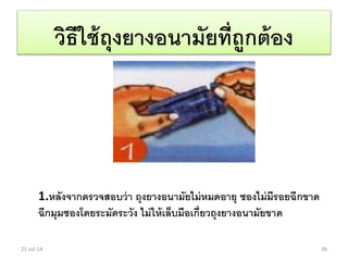 วิธีใช้ถุงยางอนามัยที่ถูกต้อง
1.หลังจากตรวจสอบว่า ถุงยางอนามัยไม่หมดอายุ ซองไม่มีรอยฉีกขาด
ฉีกมุมซองโดยระมัดระวัง ไม่ให้เล็บมือเกี่ยวถุงยางอนามัยขาด
21-Jul-14 36
 