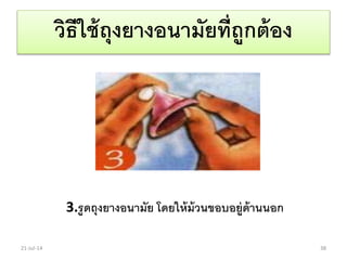 วิธีใช้ถุงยางอนามัยที่ถูกต้อง
3.รูดถุงยางอนามัย โดยให้ม้วนขอบอยู่ด้านนอก
21-Jul-14 38
 