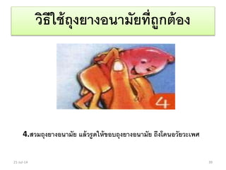 วิธีใช้ถุงยางอนามัยที่ถูกต้อง
4.สวมถุงยางอนามัย แล้วรูดให้ขอบถุงยางอนามัย ถึงโคนอวัยวะเพศ
21-Jul-14 39
 
