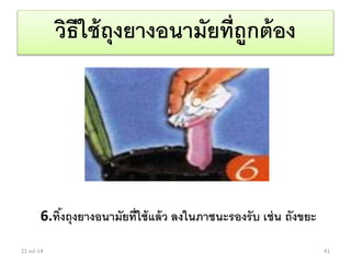 วิธีใช้ถุงยางอนามัยที่ถูกต้อง
6.ทิ้งถุงยางอนามัยที่ใช้แล้ว ลงในภาชนะรองรับ เช่น ถังขยะ
21-Jul-14 41
 