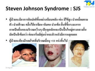 Steven Johnson Syndrome : SJS
• ผู้ป่ วยจะมีอาการผิดปกติขึ้นอย่างเฉียบพลัน เช่น มีไข้สูง ปวดเมื่อยตาม
ตัว ปวดศีรษะ คลื่นไส้อาเจียน เจ็บคอ ปวดข้อ ผื่นที่ขึ้นระยะแรก
อาจเป็นผื่นแดงบริเวณกว้างๆ เป็นจุดเล็กและเป็นปื้นใหญ่ตรงกลางผื่น
มักเป็นสีเข้มกว่า ต่อมาเริ่มมีตุ่มน้าและผิวหนังมีการหลุดลอก
• ผู้ป่ วยจะต้องมีรอยโรคที่บริเวณเยื่อบุ >11 แห่งขึ้นไป
15-Aug-14 100
 