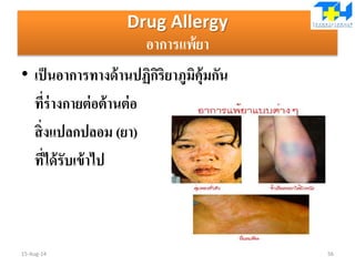 Drug Allergy
อาการแพ้ยา
• เป็นอาการทางด้านปฏิกิริยาภูมิคุ้มกัน
ที่ร่างกายต่อต้านต่อ
สิ่งแปลกปลอม (ยา)
ที่ได้รับเข้าไป
15-Aug-14 56
 