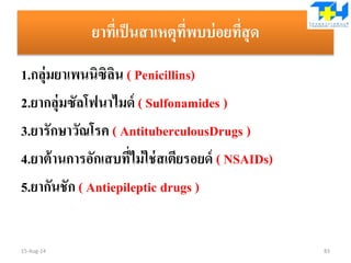 ยาที่เป็นสาเหตุที่พบบ่อยที่สุด
1.กลุ่มยาเพนนิซิลิน ( Penicillins)
2.ยากลุ่มซัลโฟนาไมด์ ( Sulfonamides )
3.ยารักษาวัณโรค ( AntituberculousDrugs )
4.ยาต้านการอักเสบที่ไม่ใช่สเตียรอยด์ ( NSAIDs)
5.ยากันชัก ( Antiepileptic drugs )
15-Aug-14 83
 
