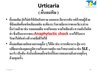 Urticaria
( ผื่นลมพิษ )
• ผื่นลมพิษ มักไม่ทาให้เกิดอันตราย นอกจาก มีอาการคัน แต่ถ้าพบผู้ป่ วย
ที่มีลมพิษขึ้นชนิดเฉียบพลัน จะต้องระวังอาจมีอาการของอวัยวะส่วน
อื่นร่วมด้วย เช่น หลอดลมตีบ หายใจหอบ หายใจเสียงดัง ความดันโลหิต
ต่า ซึ่งเป็นอาการของ Anaphylactic shock หากได้รับการ
รักษาไม่ทันท่วงที อาจเสียชีวิตได้
• ผื่นลมพิษอาจเกิดจากสาเหตุอื่น ๆ ได้อีก เช่น การแพ้อาหาร ฝุ่ น การ
เปลี่ยนแปลงอุณหภูมิความร้อนความเย็น และโรคบางอย่าง เช่น SLE ,
มะเร็ง เป็นต้น ดังนั้นเมื่อพบผื่นชนิดนี้จึงควรสอบถามถึงสาเหตุอื่นๆ
ด้วยทุกครั้ง
15-Aug-14 90
 