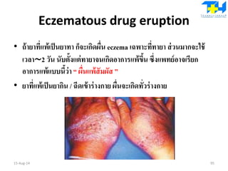 Eczematous drug eruption
• ถ้ายาที่แพ้เป็นยาทา ก็จะเกิดผื่น eczema เฉพาะที่ทายา ส่วนมากจะใช้
เวลา∼2 วัน นับตั้งแต่ทายาจนเกิดอาการแพ้ขึ้น ซึ่งแพทย์อาจเรียก
อาการแพ้แบบนี้ว่า “ ผื่นแพ้สัมผัส ”
• ยาที่แพ้เป็นยากิน / ฉีดเข้าร่างกาย ผื่นจะเกิดทั่วร่างกาย
15-Aug-14 95
 
