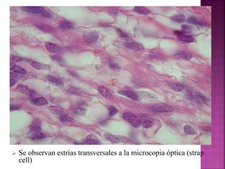  Se observan estrías transversales a la microcopia óptica (strap 
cell) 
 