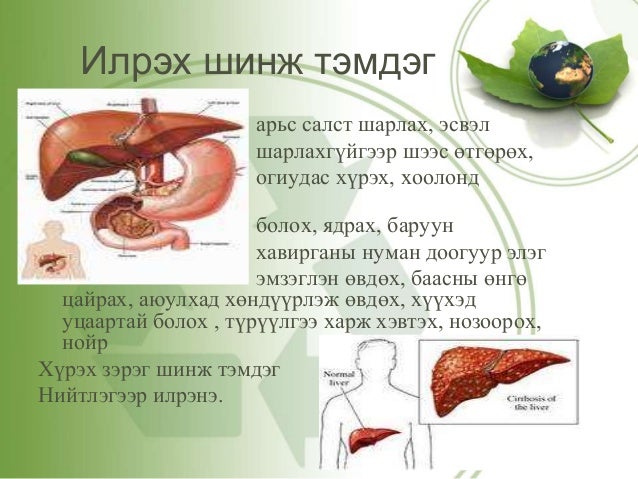 халдварт өвчин