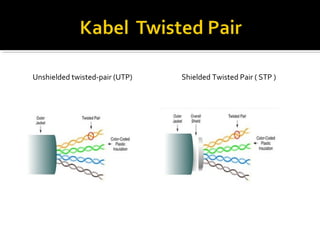 Unshielded twisted-pair (UTP) Shielded Twisted Pair ( STP ) 
 