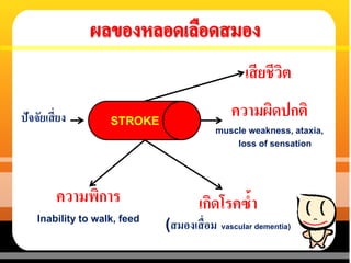 ปัจจัยเสี่ยง STROKE
เสียชีวิต
ความผิดปกติ
muscle weakness, ataxia,
loss of sensation
ความพิการ
Inability to walk, feed
เกิดโรคซ้า
(สมองเสื่อม vascular dementia)
 
