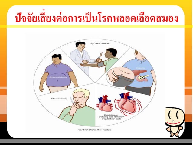 Ppt. stroke1 | PPTX