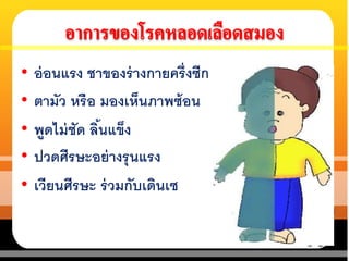 • อ่อนแรง ชาของร่างกายครึ่งซีก
• ตามัว หรือ มองเห็นภาพซ้อน
• พูดไม่ชัด ลิ้นแข็ง
• ปวดศีรษะอย่างรุนแรง
• เวียนศีรษะ ร่วมกับเดินเซ
 