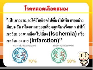 “เป็นภาวะสมองได้รับเลือดไปเลี้ยงไม่เพียงพออย่าง
เฉียบพลัน เนื่องจากหลอดเลือดอุดตันหรือแตก ทาให้
เซลล์สมองขาดเลือดไปเลี้ยง (Ischemia) หรือ
เซลล์สมองตาย (Infarction)”
 
