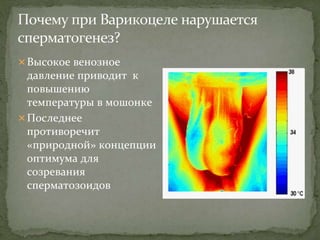 Высокое венозное
давление приводит к
повышению
температуры в мошонке
Последнее
противоречит
«природной» концепции
оптимума для
созревания
сперматозоидов
 