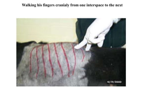 Walking his fingers cranialy from one interspace to the next
 