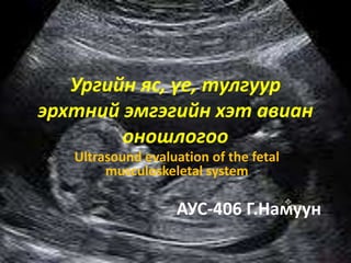 Ургийн яс, үе, тулгуур
эрхтний эмгэгийн хэт авиан
оношлогоо
Ultrasound evaluation of the fetal
musculoskeletal system
АУС-406 Г.Намуун
 